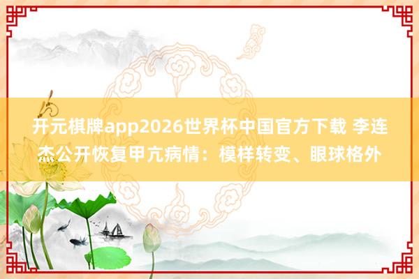 开元棋牌app2026世界杯中国官方下载 李连杰公开恢复甲亢病情：模样转变、眼球格外